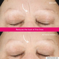 Ageless 10% Phyto-Lactic Radiance Facial