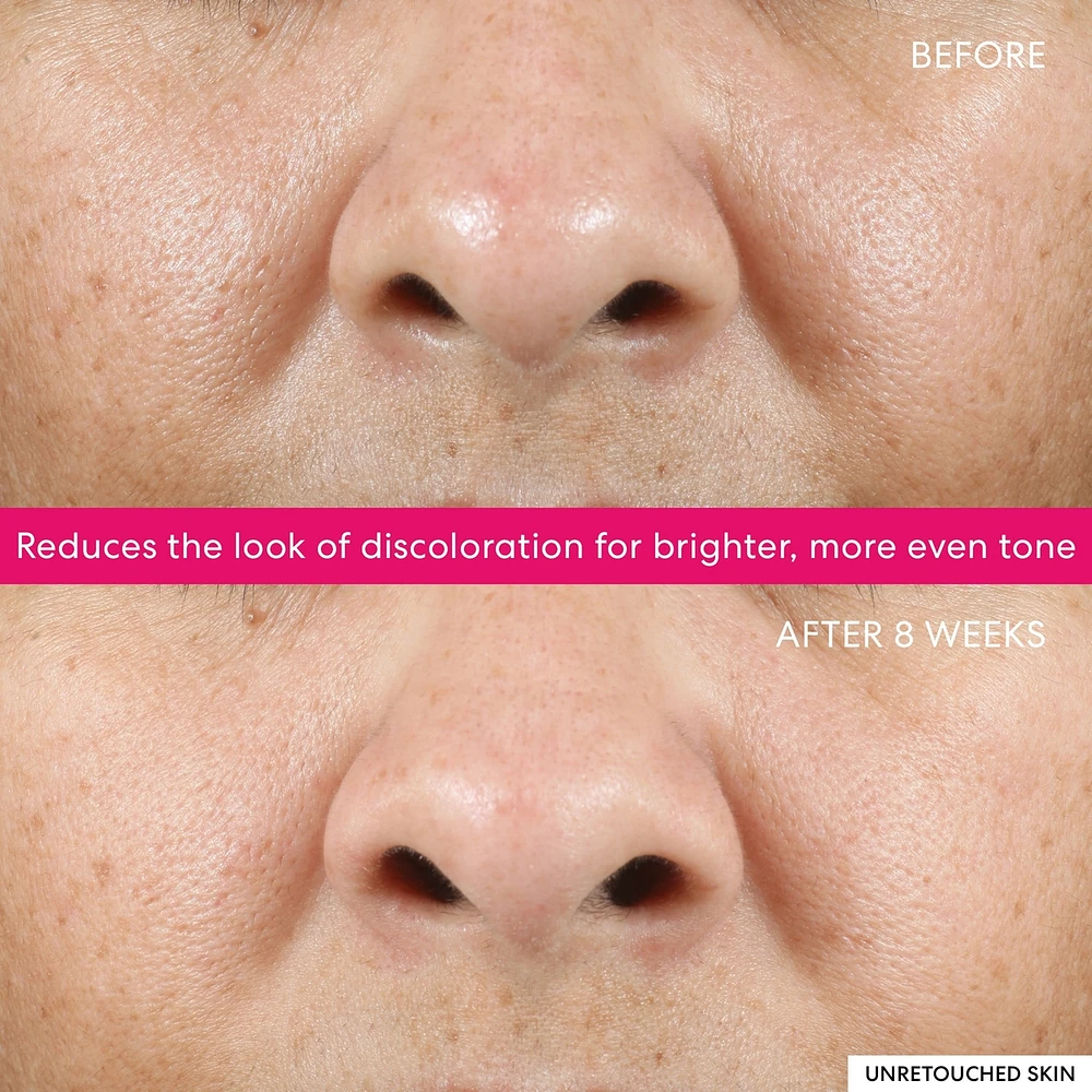 Ageless 10% Phyto-Lactic Radiance Facial