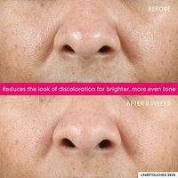 Ageless 10% Phyto-Lactic Radiance Facial