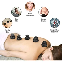 Cupping therapy set
