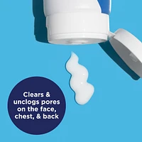 Acne Wash, 4% Benzoyl Peroxide Cream