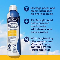 Acne Banishing Body Spray