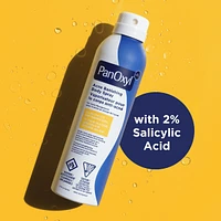 Acne Banishing Body Spray