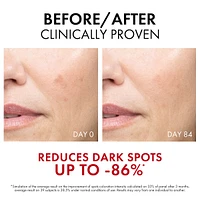 Vichy Liftactiv B3 Dark Spots & Wrinkles Serum