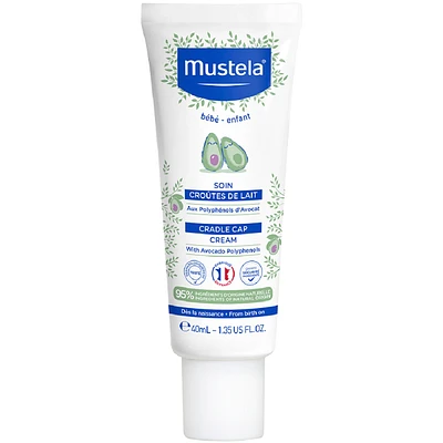Cradle Cap Cream