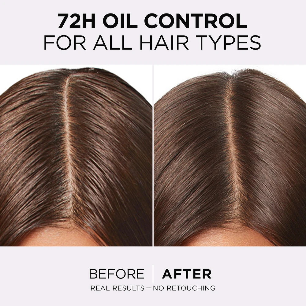 Hair Expertise, Hyaluron Pure Oil Erasing Scalp Serum, with Salicylic Acid, for Oily Roots and Dehydrated Lengths, 102ml
