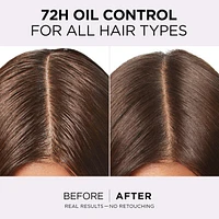 Hair Expertise, Hyaluron Pure Oil Erasing Scalp Serum, with Salicylic Acid, for Oily Roots and Dehydrated Lengths, 102ml