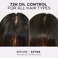 Hair Expertise, Hyaluron Pure Oil Erasing Scalp Serum, with Salicylic Acid, for Oily Roots and Dehydrated Lengths, 102ml