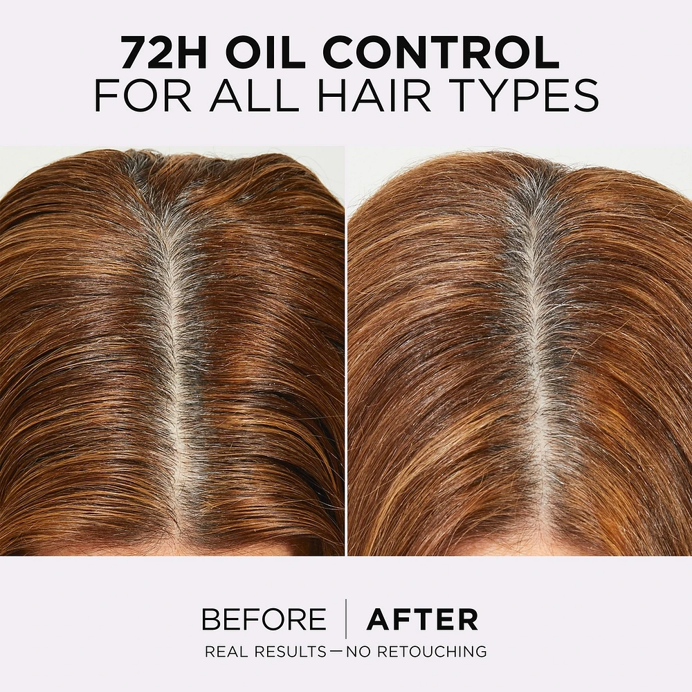 Hair Expertise, Hyaluron Pure Oil Erasing Scalp Serum, with Salicylic Acid, for Oily Roots and Dehydrated Lengths, 102ml