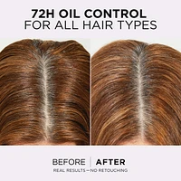 Hair Expertise, Hyaluron Pure Oil Erasing Scalp Serum, with Salicylic Acid, for Oily Roots and Dehydrated Lengths, 102ml