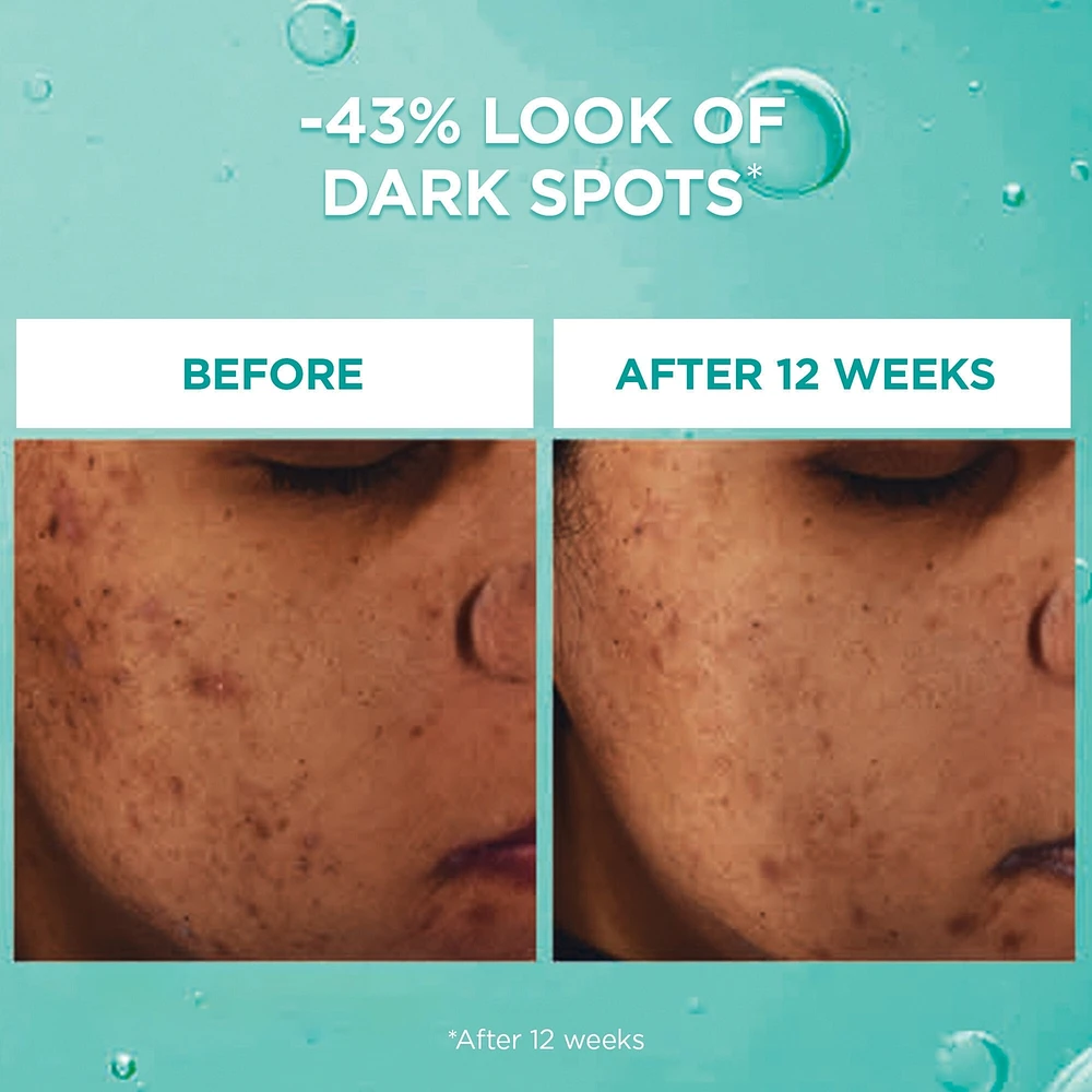 Bright Reveal Dark Spot Face Serum with 12% Niacinamide + Ferulic + Amino Sulfonic Acids