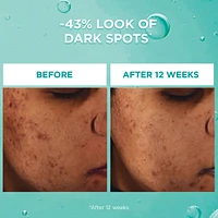 Bright Reveal Dark Spot Face Serum with 12% Niacinamide + Ferulic + Amino Sulfonic Acids