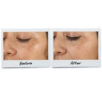 Clearly Corrective™ Dark Spot Solution