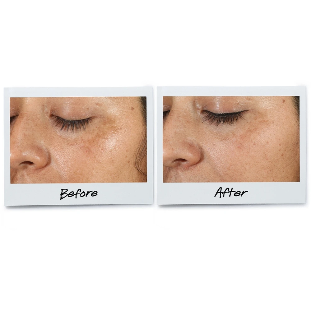 Clearly Corrective™ Dark Spot Solution