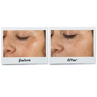 Clearly Corrective™ Dark Spot Solution