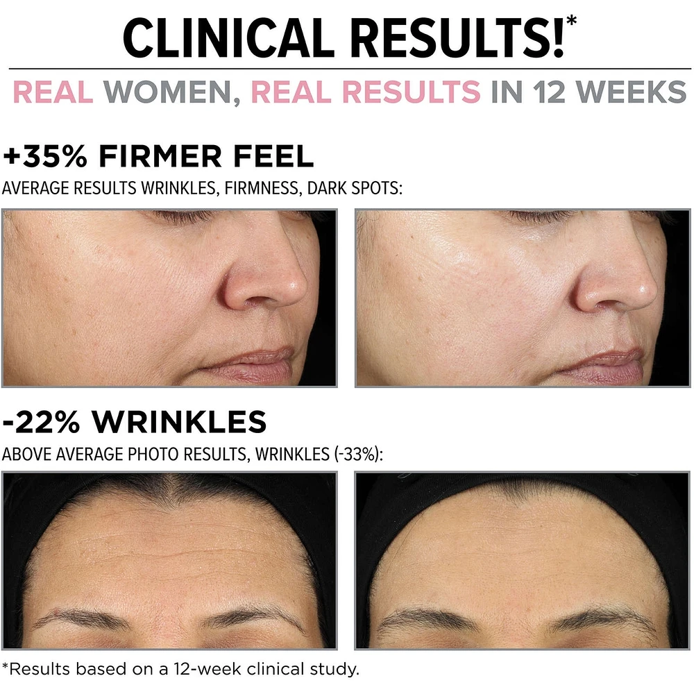 Hello Results Wrinkle-Reducing Daily Retinol Serum-in-Cream