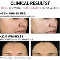 Hello Results Wrinkle-Reducing Daily Retinol Serum-in-Cream