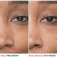10% Glycolic Acid, Hyaluronic Acid Bye Bye Pores Concentrated Derma Serum