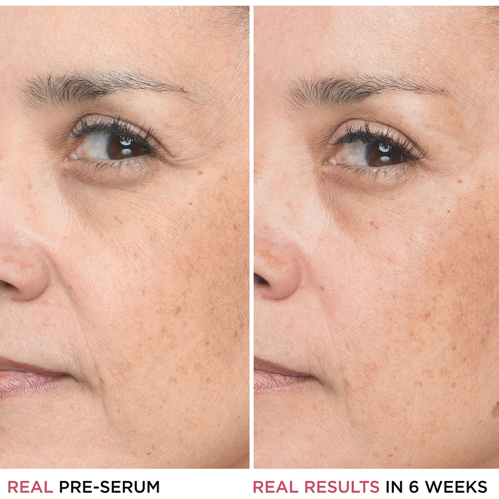 1.5% Hyaluronic Acid, Peptide Bye Bye Lines Concentrated Derma Serum