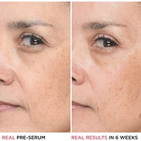 1.5% Hyaluronic Acid, Peptide Bye Bye Lines Concentrated Derma Serum