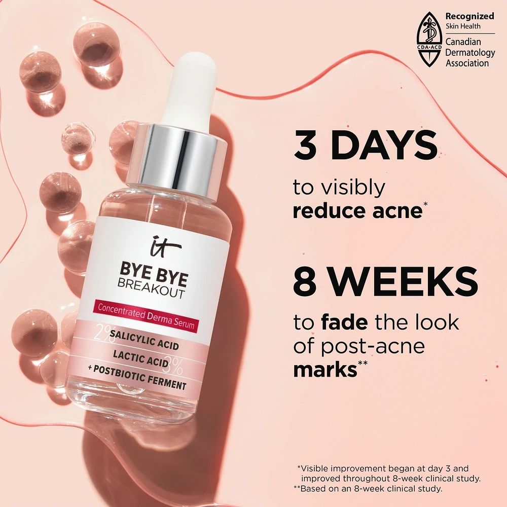 Bye Bye Breakout 2% Salicylic Acid Serum Acne Treatment