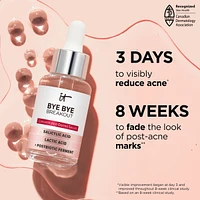 Bye Bye Breakout 2% Salicylic Acid Serum Acne Treatment