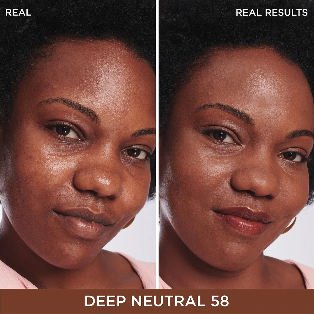 Bye Dark Spots Concealer + Serum with 2% Niacinamide

INSTANT NATURAL COVERAGE CLINICALLY FADES DRAK SPOTS*