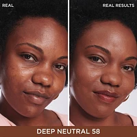 Bye Dark Spots Concealer + Serum with 2% Niacinamide

INSTANT NATURAL COVERAGE CLINICALLY FADES DRAK SPOTS*