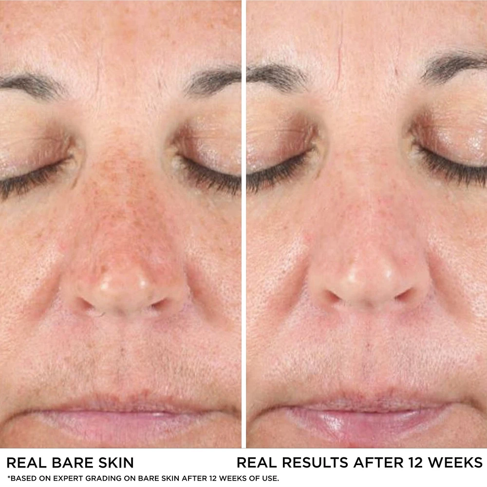 Bye Dark Spots Concealer + Serum with 2% Niacinamide

INSTANT NATURAL COVERAGE CLINICALLY FADES DRAK SPOTS*