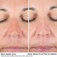 Bye Dark Spots Concealer + Serum with 2% Niacinamide

INSTANT NATURAL COVERAGE CLINICALLY FADES DRAK SPOTS*