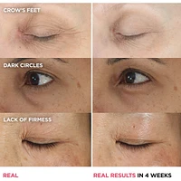 Confidence in an Eye Cream Anti Aging Peptide Eye Cream