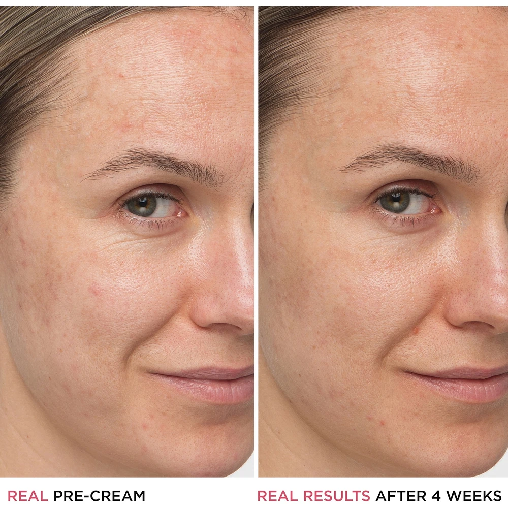 Confidence in a Cream Anti Aging Hydrating Moisturizer