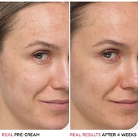 Confidence in a Cream Anti Aging Hydrating Moisturizer