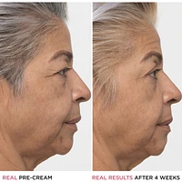 Confidence in a Cream Anti Aging Hydrating Moisturizer