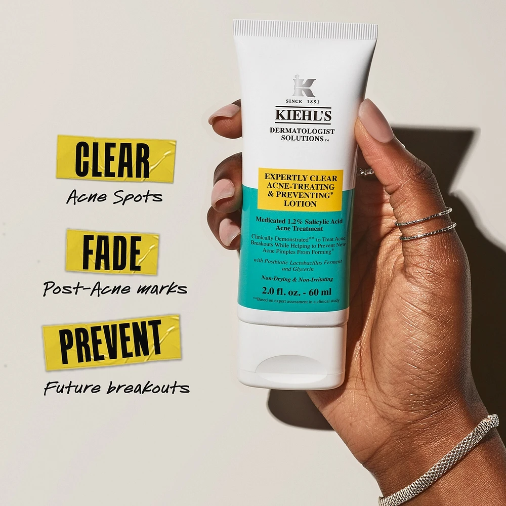 Expertly Clear Acne Treating Lotion - Clinically Proven Daily Defense Against Acne