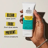 Expertly Clear Acne Treating Lotion - Clinically Proven Daily Defense Against Acne