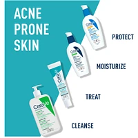 Acne Control Gel