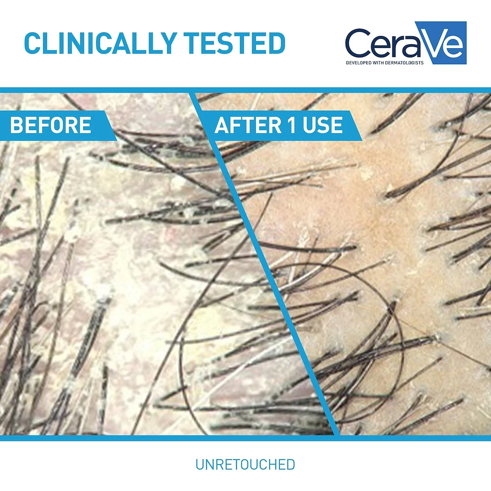 CeraVe 2-in-1 Anti-Dandruff Hydrating Shampoo and Conditioner