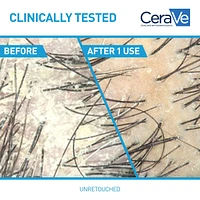 CeraVe Anti-Dandruff Hydrating Shampoo