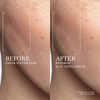 Rénergie H.C.F. Triple Serum with Hyaluronic Acid