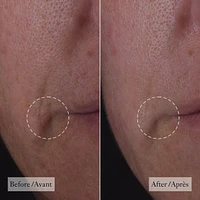 dose of wisdom™ bouncy skin reactivating serum in-depth hydration and collagen support loaded with oxygen, vitamin C hyaluronic acid