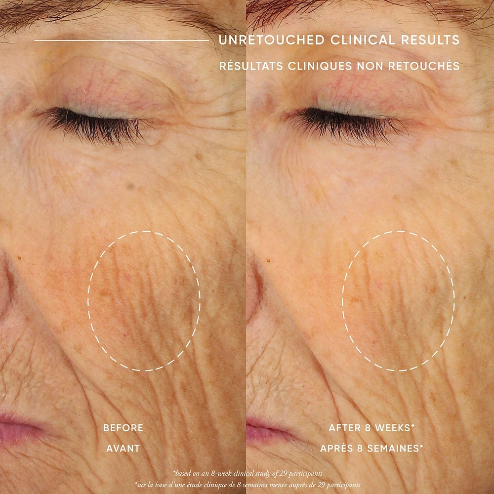 ultimate miracle worker nourish & rejuvenate face & neck cream
