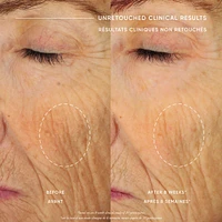 ultimate miracle worker nourish & rejuvenate face & neck cream