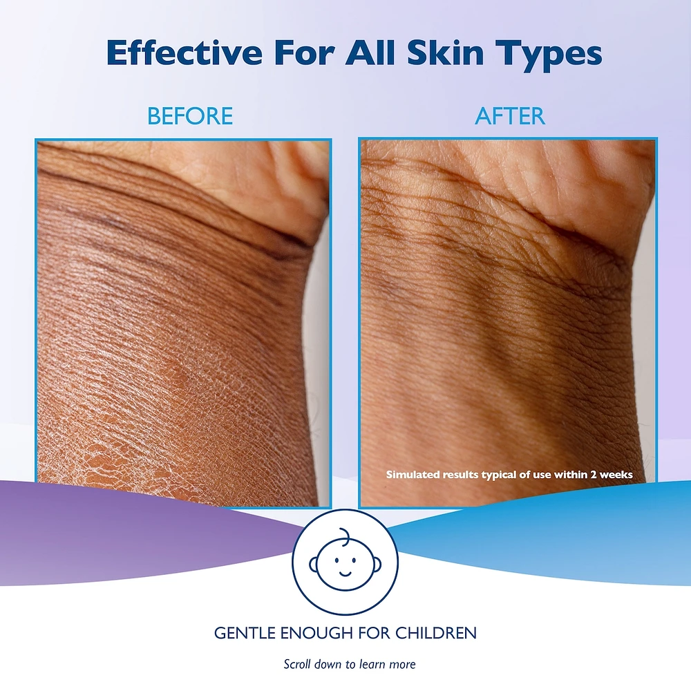 Moisturizing Lotion With Vitamin E