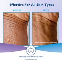 Moisturizing Lotion With Vitamin E