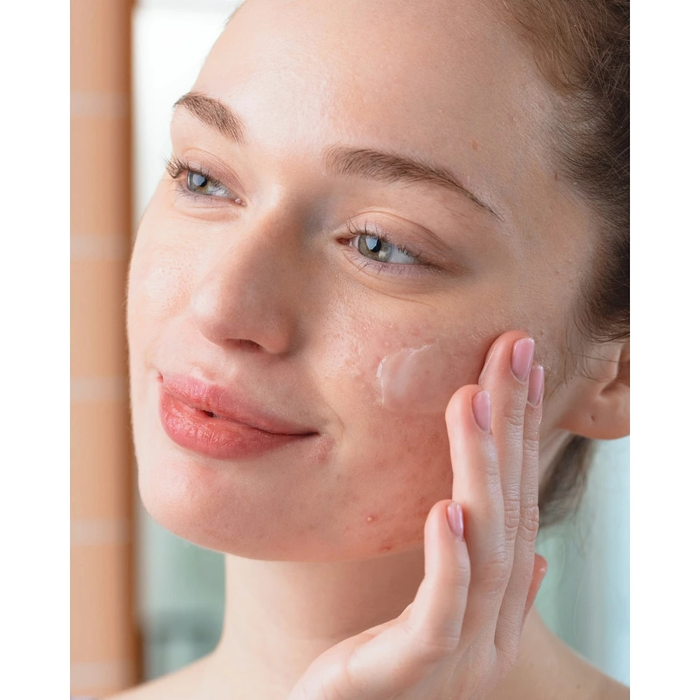 Sebiaclear Active Gel 40ml