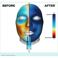 Hydra-Essentiel [HA²] Bi-phase Serum