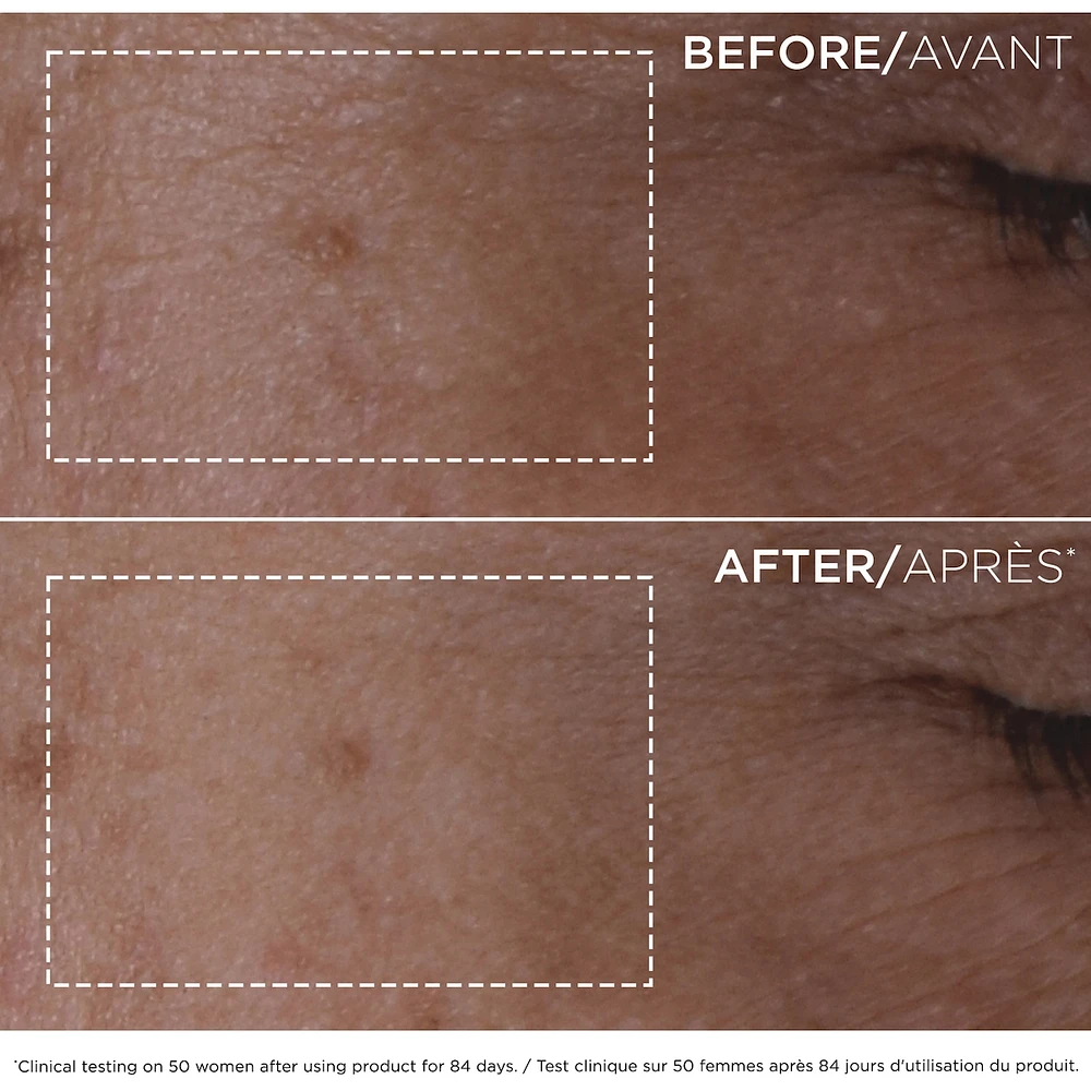Double Serum (30mL)