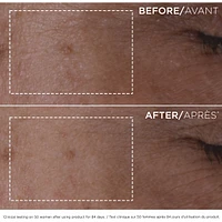 Double Serum (30mL)