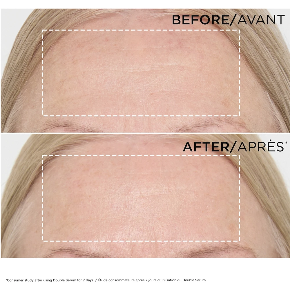 Double Serum (30mL)